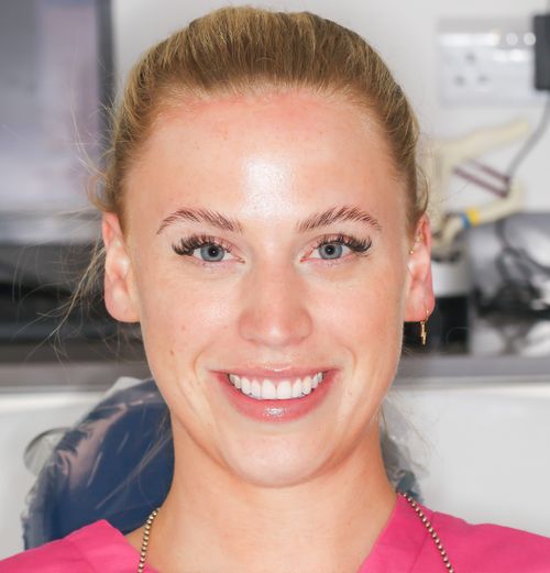 Composite Bonding  - Shannen Heffernan Before
